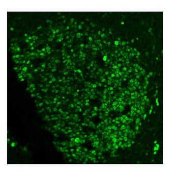 Anti-Ki67 Antibody (monoclonal, 5E12)