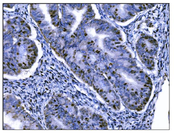 Anti-Ki67 Antibody (monoclonal, 5E12)