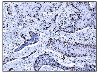 Anti-Ki67 Antibody (monoclonal, 5E12)