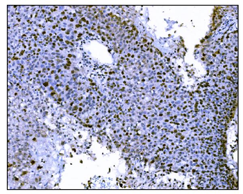 Anti-Ki67 Antibody (monoclonal, 5E12)