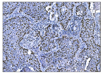 Anti-Ki67 Antibody (monoclonal, 5E12)