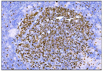 Anti-Ki67 Antibody (monoclonal, 5E12)