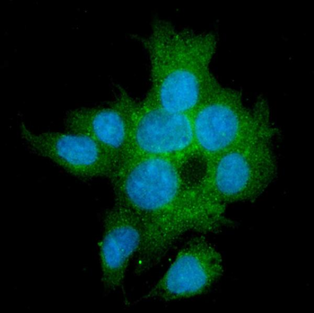 Anti-TGFBR2 Antibody (monoclonal, 2F11)