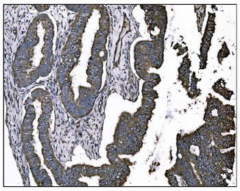 Anti-TGFBR2 Antibody (monoclonal, 2F11)