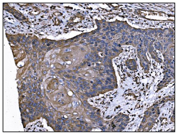 Anti-TGFBR2 Antibody (monoclonal, 2F11)