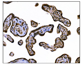 Anti-TGFBR2 Antibody (monoclonal, 2F11)