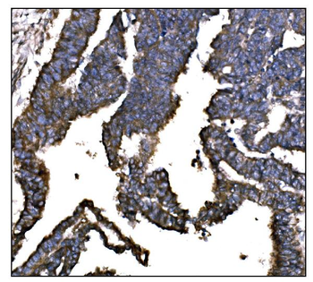Anti-IGF2R Antibody (monoclonal, 4I11)