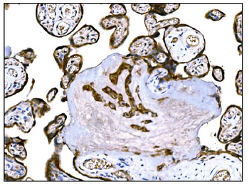 Anti-IGF2R Antibody (monoclonal, 4I11)
