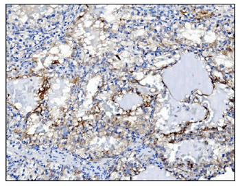 Anti-PGP9.5 Antibody (monoclonal, 3E4)