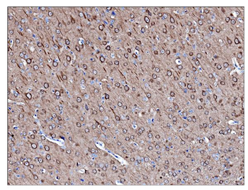 Anti-PGP9.5 Antibody (monoclonal, 3E4)