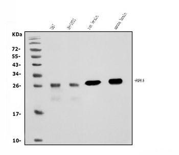 Anti-PGP9.5 Antibody (monoclonal, 3E4)