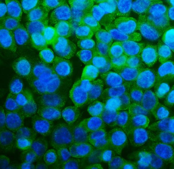 Anti-RPL13A Antibody (monoclonal, 4C9)