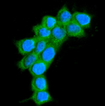 Anti-AlaRS/AARS1 Antibody