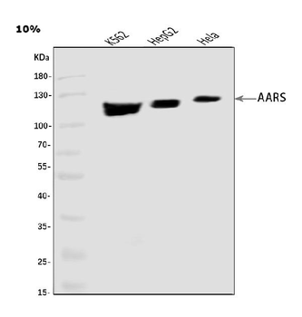 Anti-AlaRS/AARS1 Antibody