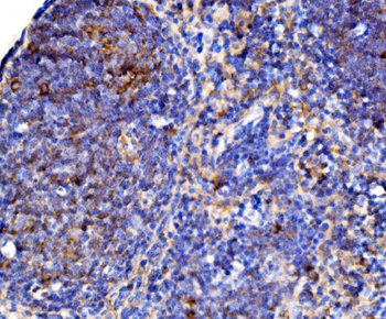 Cd38 Antibody