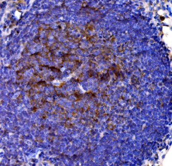 Cd38 Antibody