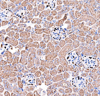 Anti-p57 Kip2/CDKN1C Antibody