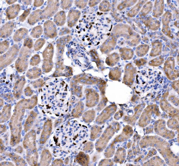 Anti-p57 Kip2/CDKN1C Antibody