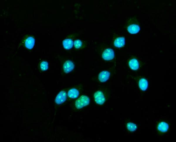 Anti-CENPB Antibody