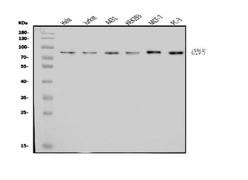 Anti-CENPB Antibody
