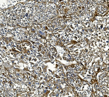 Anti-COL4A3 Antibody