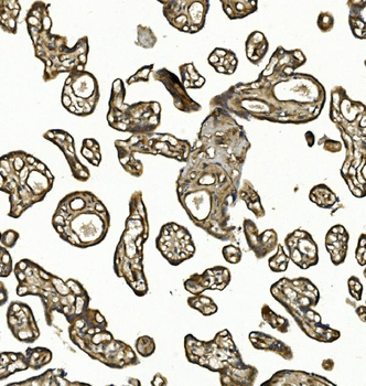 Anti-COL4A3 Antibody