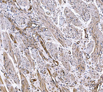 Anti-COL4A3 Antibody