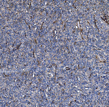 Anti-COL4A3 Antibody
