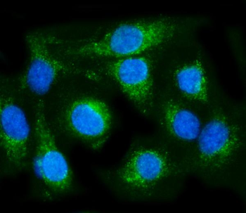 Anti-COX6B1 Antibody