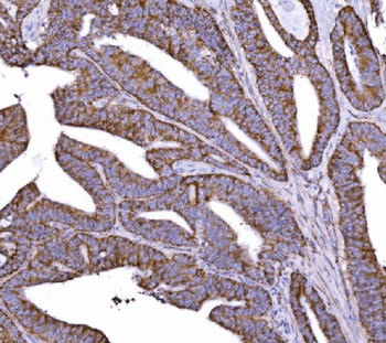Anti-COX6B1 Antibody