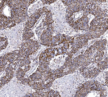 Anti-COX6B1 Antibody