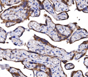 Anti-COX6B1 Antibody