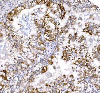 Anti-COX6B1 Antibody