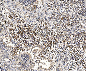 Anti-DAP1/DAP Antibody