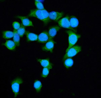 Anti-DIAPH1 Antibody
