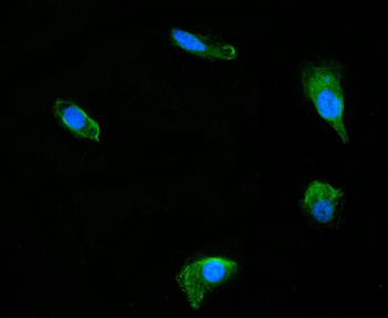 Anti-DUSP6 Antibody