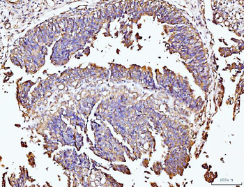 Anti-DUSP6 Antibody