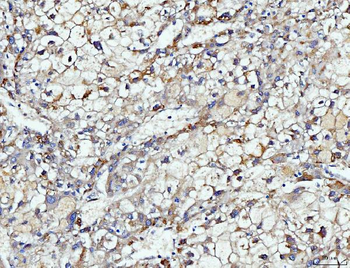 Anti-DUSP6 Antibody