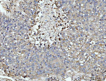 Anti-DUSP6 Antibody