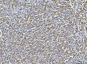 Anti-DUSP6 Antibody