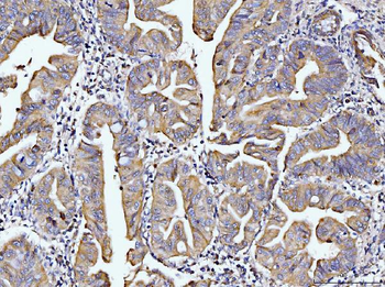 Anti-DUSP6 Antibody
