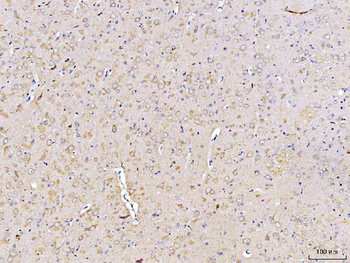 Anti-DUSP6 Antibody
