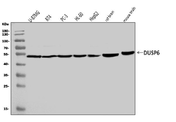 Anti-DUSP6 Antibody