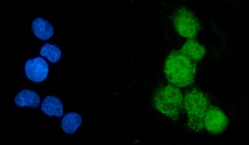 Anti-EEF2K Antibody