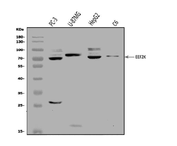 Anti-EEF2K Antibody