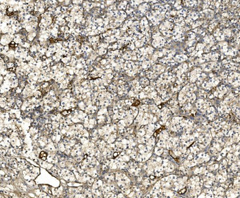 Anti-EIF3C Antibody