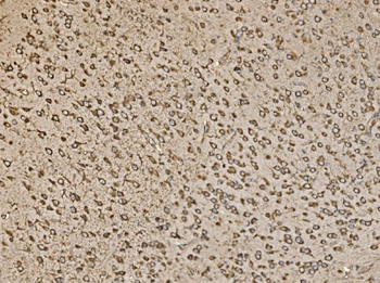 Anti-EIF5 Antibody