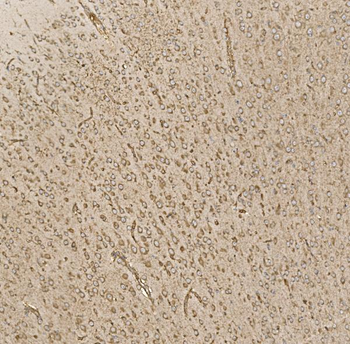 Anti-EIF5 Antibody