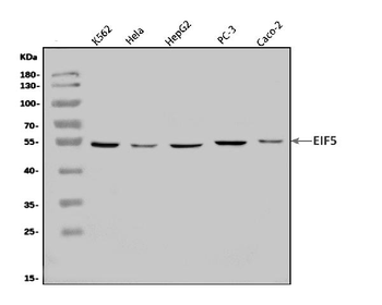 Anti-EIF5 Antibody