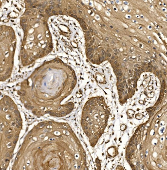 Anti-EIF5 Antibody